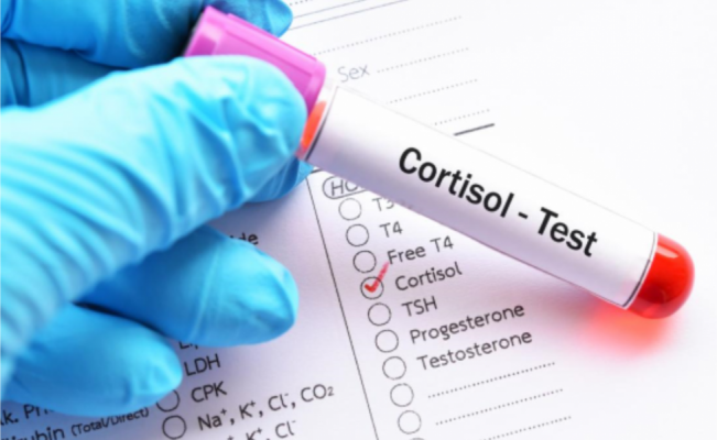 Cortisol: Friend Or Foe?